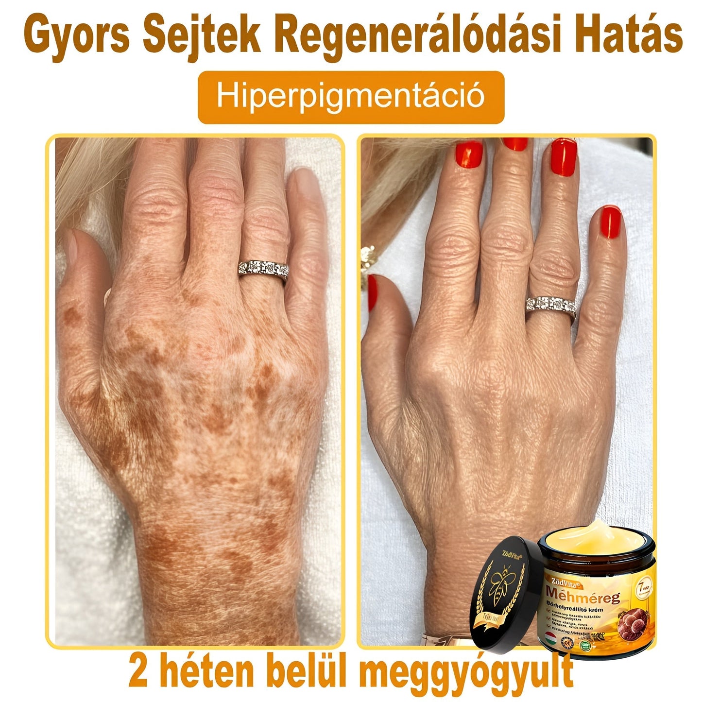 🌟🌟 ZödVita® Méhméreg Bőr Helyreállító Krém 🔥Természetes Öregedésgátló, Feszesíti a Bőrt, Csökkenti a Ráncokat– 50ml