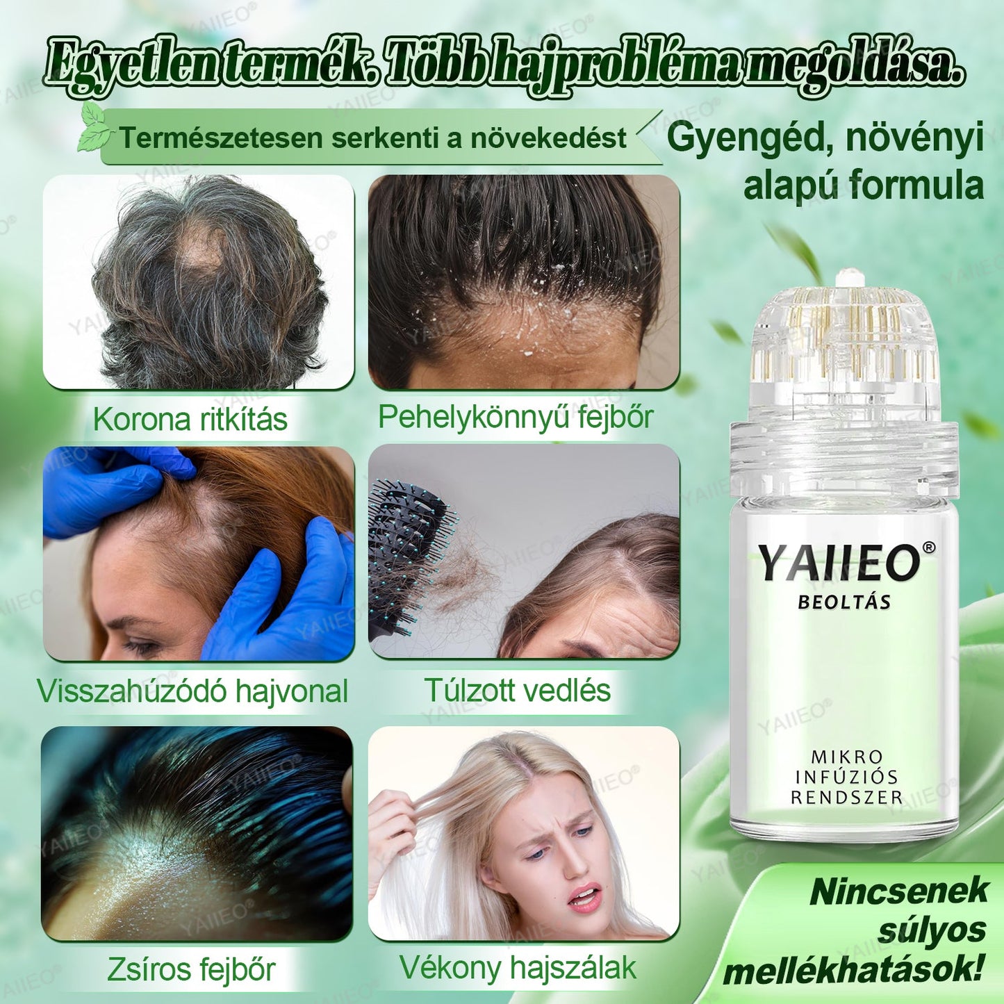 🫒🫒🫒YAIIEO® Fájdalommentes Mikroinfúziós Hajhullás Elleni Rendszer – ✅DHT-Blokkolás, Hajhagymák Újraélesztése és Látványosan Dúsabb Haj