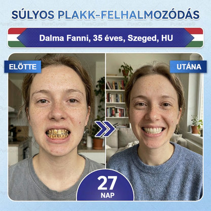 🦷🦷PuraCure® többhatású fog- és ínyregeneráló szájvíz | Kollagén × posztbiotikumok × β-glükanáz