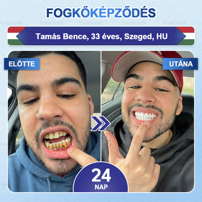 🦷🦷PuraCure® többhatású fog- és ínyregeneráló szájvíz | Kollagén × posztbiotikumok × β-glükanáz