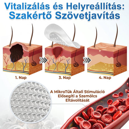 🎁🔥🎁 Gratulálunk! Ön kiválasztásra került mai exkluzív ajánlatunkhoz! Most 30% kedvezménnyel szerezheti be a PuraCure® MIKROTŰS TISZTÍTÓ TAPASZOK! 🌿 Ne hagyja ki ezt a lehetőséget – a készlet korlátozott, rendelje hozzá most kedvezményesen!