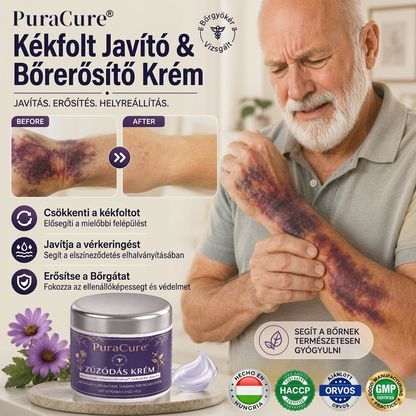 🔥100K+ ELADVA 💁‍♀️ – 💜PuraCure® Zúzódásjavító és bőrerősítő krém