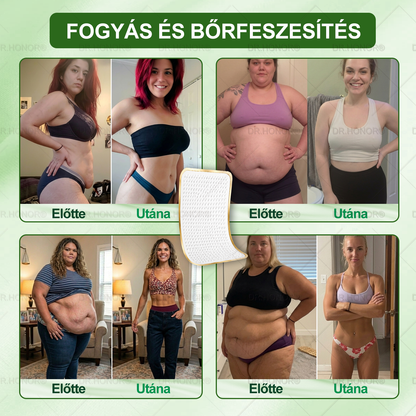 [2026 ÚJ & Továbbfejlesztett🎁Akár 80% KEDVEZMÉNY]🍃🍃 DR.HONOR® Nano-mikrotűs Fogyasztó Tapasz – Ultra-erős 5× Peptidkomplex • Támogatja a Fogyást és Nyirokkeringést • Kényelmes Fogyás• Támogatja az Ízületi Komfortot és a Mély Alvást