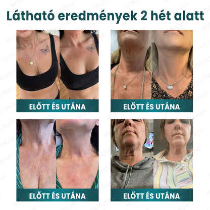 ✨ NORUION® Q10 x Növényi Nano Exoszóma Haladó Ránctalanító Krém - Mélyregeneráló, Kollagénfokozó & Bőrfeszesítő Technológia
