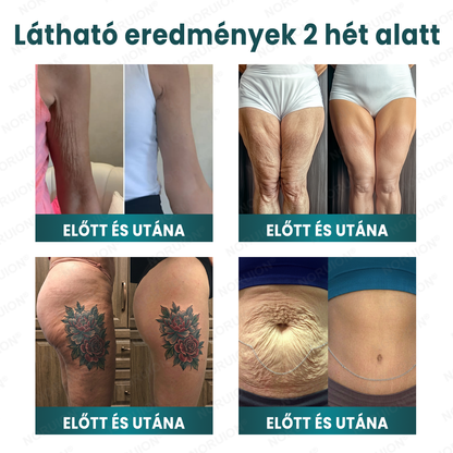 ✨✨ NORUION® Q10 x Növényi Nano Exoszóma Haladó Ránctalanító Krém – ✅Haladó Ránctalanító, Bőrfeszesítő & Regeneráló Formula (Látható Hatás Már 14 Nap Alatt)