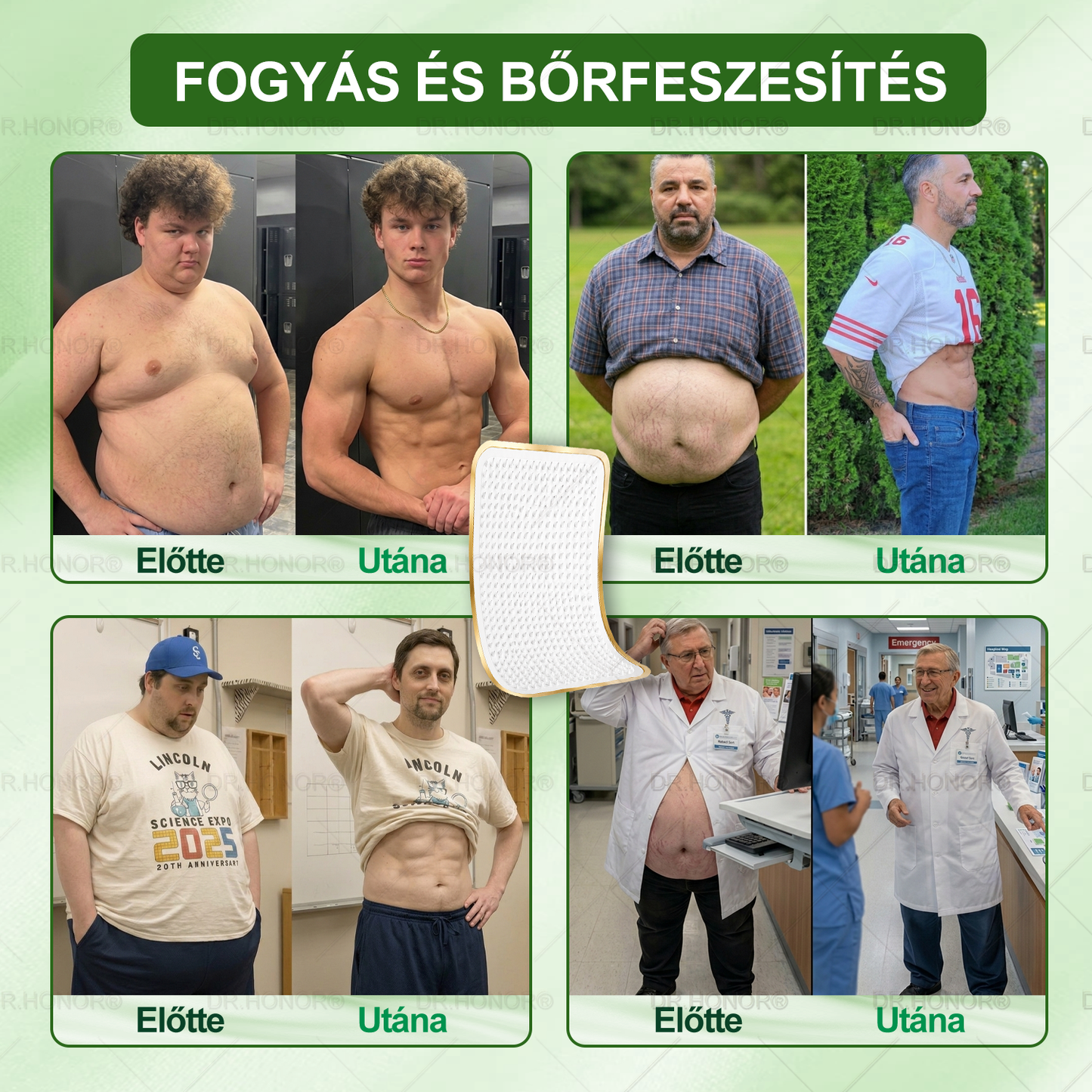 [2026 ÚJ & Továbbfejlesztett🎁Akár 80% KEDVEZMÉNY]🍃🍃 DR.HONOR® Nano-mikrotűs Fogyasztó Tapasz – Ultra-erős 5× Peptidkomplex • Támogatja a Fogyást és Nyirokkeringést • Kényelmes Fogyás• Támogatja az Ízületi Komfortot és a Mély Alvást