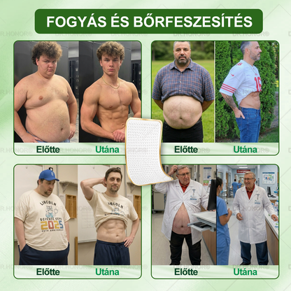 [2026 ÚJ & Továbbfejlesztett🎁Akár 80% KEDVEZMÉNY]🍃🍃 DR.HONOR® Nano-mikrotűs Fogyasztó Tapasz – Ultra-erős 5× Peptidkomplex • Támogatja a Fogyást és Nyirokkeringést • Kényelmes Fogyás• Támogatja az Ízületi Komfortot és a Mély Alvást