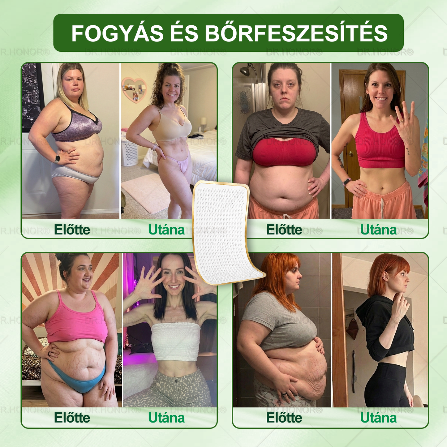[2026 ÚJ & Továbbfejlesztett🎁Akár 80% KEDVEZMÉNY]🍃🍃 DR.HONOR® Nano-mikrotűs Fogyasztó Tapasz – Ultra-erős 5× Peptidkomplex • Támogatja a Fogyást és Nyirokkeringést • Kényelmes Fogyás• Támogatja az Ízületi Komfortot és a Mély Alvást