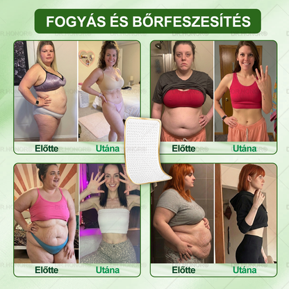 [2026 ÚJ & Továbbfejlesztett🎁Akár 80% KEDVEZMÉNY]🍃🍃 DR.HONOR® Nano-mikrotűs Fogyasztó Tapasz – Ultra-erős 5× Peptidkomplex • Támogatja a Fogyást és Nyirokkeringést • Kényelmes Fogyás• Támogatja az Ízületi Komfortot és a Mély Alvást