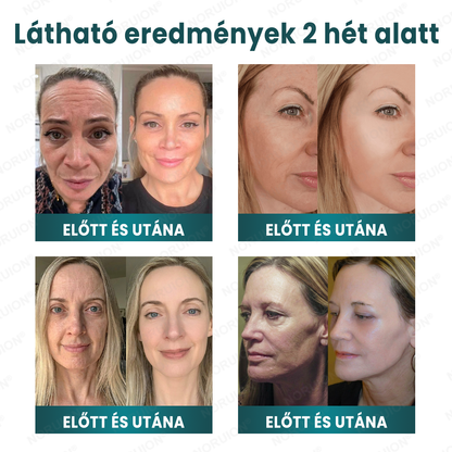 ✨ NORUION® Q10 x Növényi Nano Exoszóma Haladó Ránctalanító Krém - Mélyregeneráló, Kollagénfokozó & Bőrfeszesítő Technológia