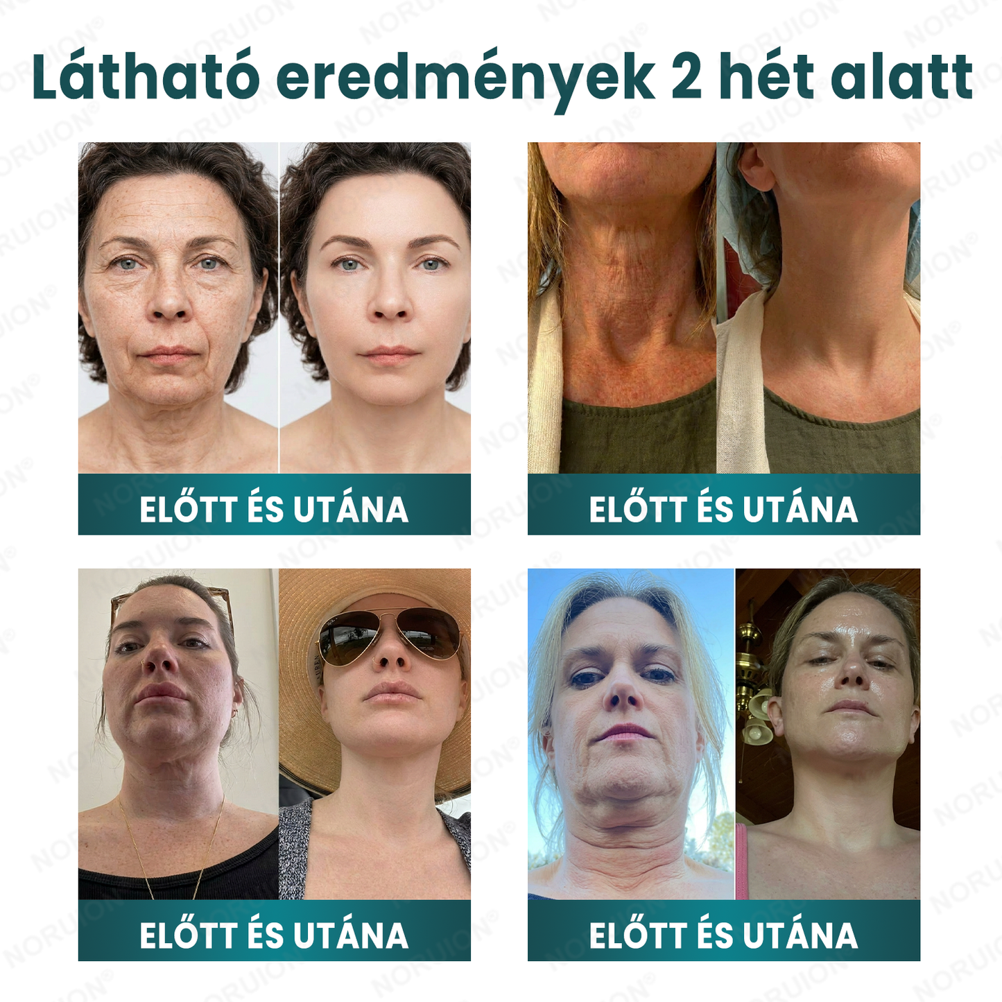 ✨ NORUION® Q10 x Növényi Nano Exoszóma Haladó Ránctalanító Krém - Mélyregeneráló, Kollagénfokozó & Bőrfeszesítő Technológia