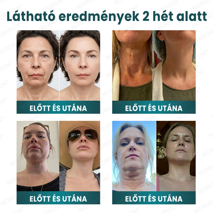 ✨ NORUION® Q10 x Növényi Nano Exoszóma Haladó Ránctalanító Krém - Mélyregeneráló, Kollagénfokozó & Bőrfeszesítő Technológia