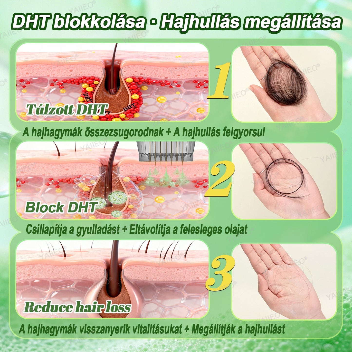 🫒🫒🫒YAIIEO® Fájdalommentes Mikroinfúziós Hajhullás Elleni Rendszer – ✅DHT-Blokkolás, Hajhagymák Újraélesztése és Látványosan Dúsabb Haj
