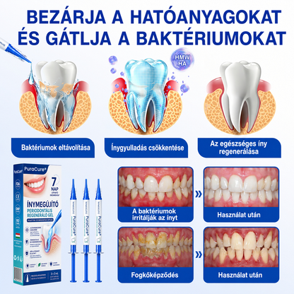 💧💧PuraCure® Ínymegújító – 🦷Célzott ínyápoló és regeneráló gél