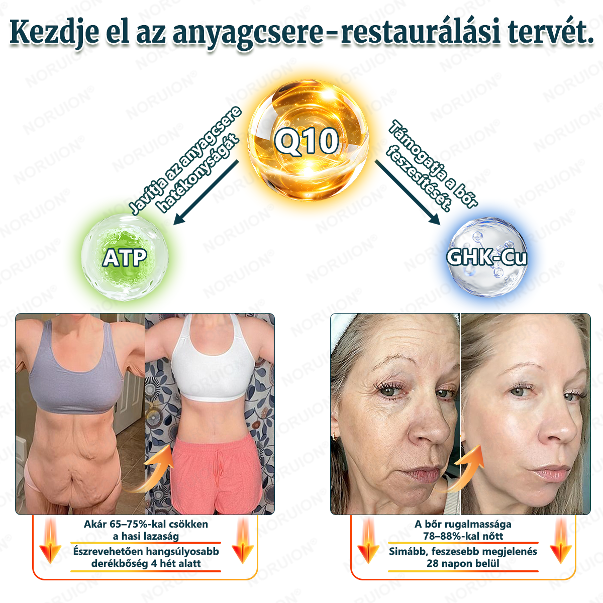✨ NORUION® Q10 x Növényi Nano Exoszóma Haladó Ránctalanító Krém - Mélyregeneráló, Kollagénfokozó & Bőrfeszesítő Technológia