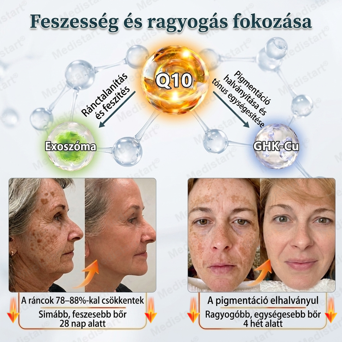 🔥🎁🔥 Gratulálunk! Ön kiválasztásra került mai exkluzív ajánlatunkhoz! Adja hozzá a NORUION® Q10 Ránctalanító Krémet rendeléséhez kedvezményes áron!✨ Több törődés az érettebb bőr mindennapi ápolásához.