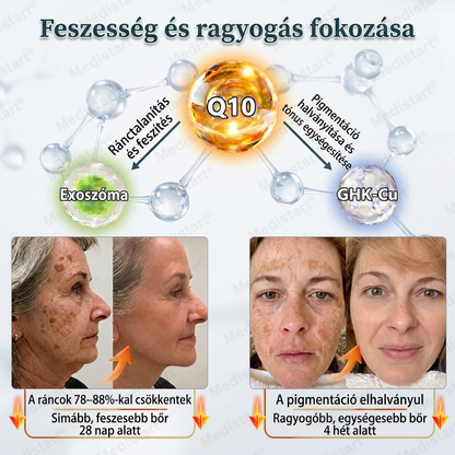 🔥🎁🔥 Gratulálunk! Ön kiválasztásra került mai exkluzív ajánlatunkhoz! Adja hozzá a NORUION® Q10 Ránctalanító Krémet rendeléséhez kedvezményes áron!✨ Több törődés az érettebb bőr mindennapi ápolásához.