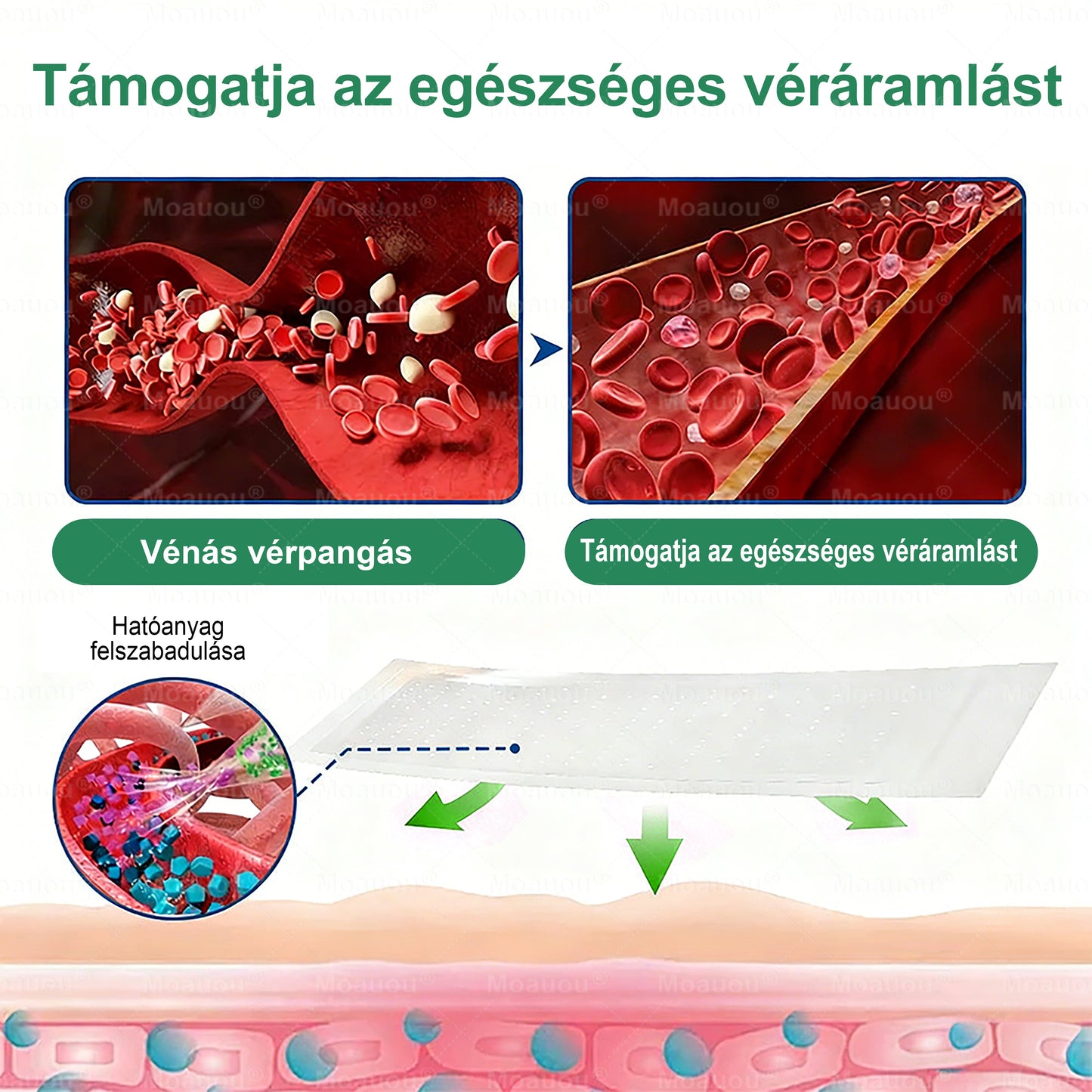 🌿🌿Moauou® Visszérápoló Mikrotűs Tapasz –👨‍⚕️Célzott ápolás fáradt, nehéz és feszülő lábakra | NAGY AKCIÓ!