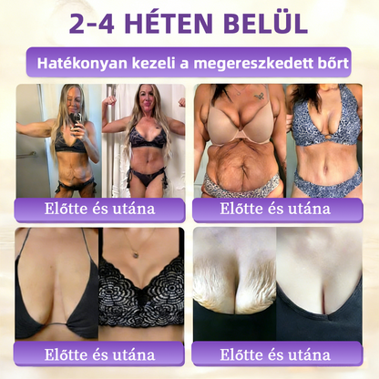 💟Magyarországról szállítva ✨ NORUION® Biotin 10 az 1-ben bőrmegújító krém