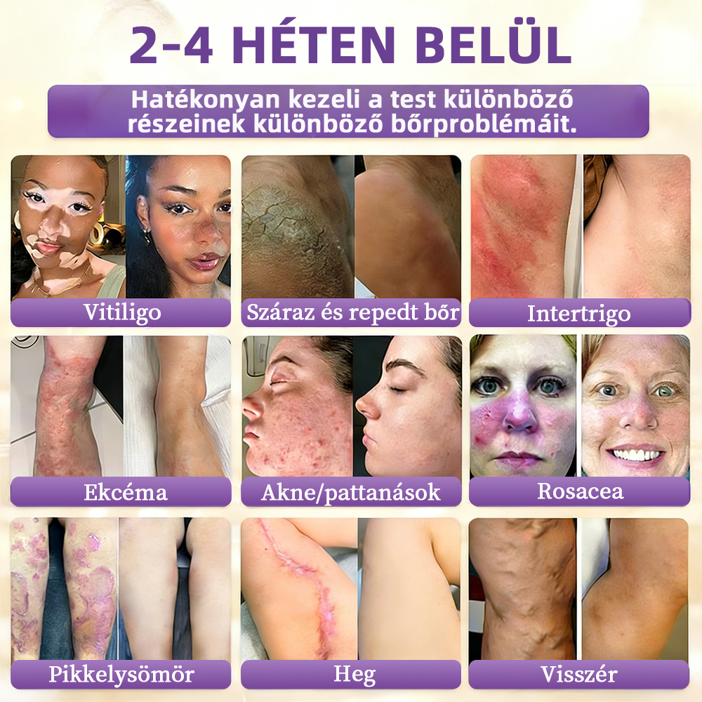 💟Magyarországról szállítva ✨ NORUION® Biotin 10 az 1-ben bőrmegújító krém