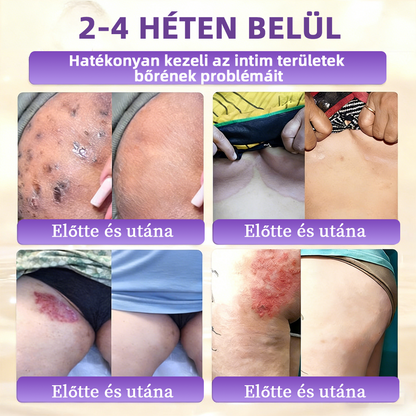 💟Magyarországról szállítva ✨ NORUION® Biotin 10 az 1-ben bőrmegújító krém