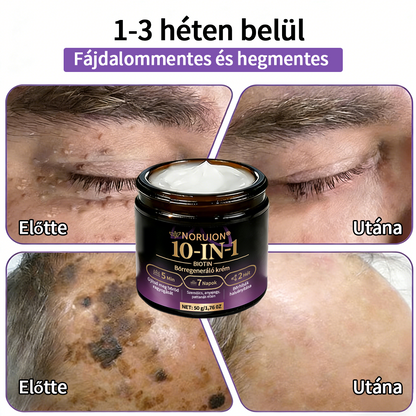 💟Magyarországról szállítva ✨ NORUION® Biotin 10 az 1-ben bőrmegújító krém
