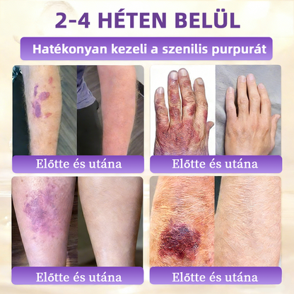 💟Magyarországról szállítva ✨ NORUION® Biotin 10 az 1-ben bőrmegújító krém