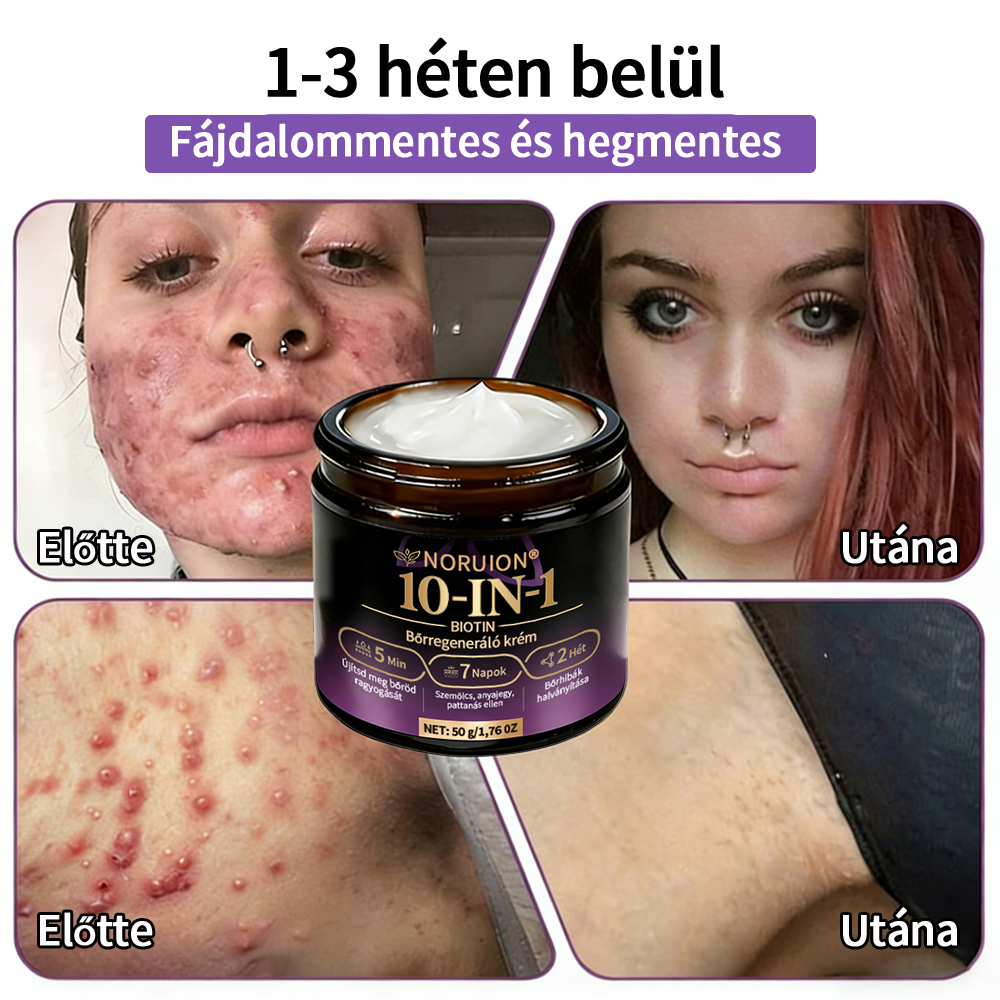 💟Magyarországról szállítva ✨ NORUION® Biotin 10 az 1-ben bőrmegújító krém