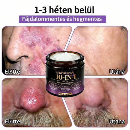 💟Magyarországról szállítva ✨ NORUION® Biotin 10 az 1-ben bőrmegújító krém