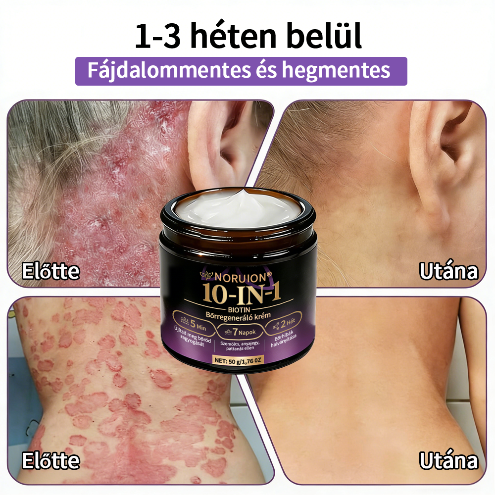 💟Magyarországról szállítva ✨ NORUION® Biotin 10 az 1-ben bőrmegújító krém