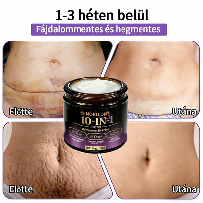 💟Magyarországról szállítva ✨ NORUION® Biotin 10 az 1-ben bőrmegújító krém