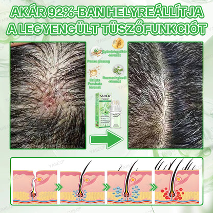 🫒🫒🫒YAIIEO® Fájdalommentes Mikroinfúziós Hajhullás Elleni Rendszer – ✅DHT-Blokkolás, Hajhagymák Újraélesztése és Látványosan Dúsabb Haj