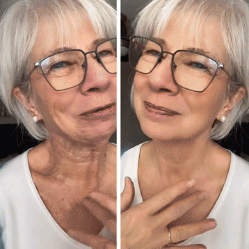 ✨✨ NORUION® Q10 x Növényi Nano Exoszóma Haladó Ránctalanító Krém – ✅Haladó Ránctalanító, Bőrfeszesítő & Regeneráló Formula (Látható Hatás Már 14 Nap Alatt)