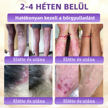 💟Magyarországról szállítva ✨ NORUION® Biotin 10 az 1-ben bőrmegújító krém
