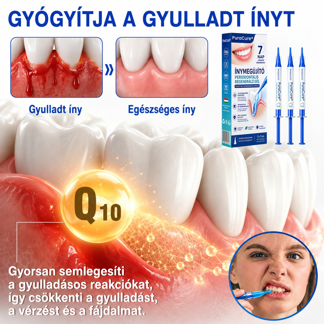 💧💧PuraCure® Ínymegújító – 🦷Célzott ínyápoló és regeneráló gél