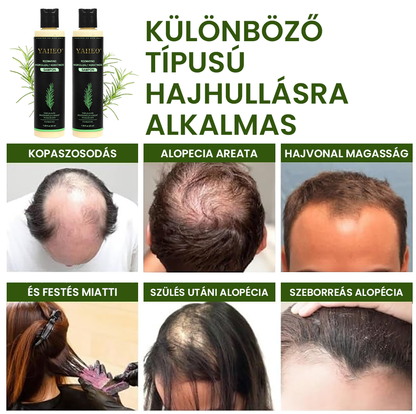 🌱 𝗬𝗔𝗜𝗜𝗘𝗢® 𝗕𝗶𝗼 𝗥𝗼𝘇𝗺𝗮𝗿𝗶𝗻𝗼𝘀 𝗛𝗮𝗷𝗻ö𝘃𝗲𝗸𝗲𝗱é𝘀𝘁 𝗦𝗲𝗿𝗸𝗲𝗻𝘁ő 𝗦𝗮𝗺𝗽𝗼𝗻 & 𝗛𝗮𝗷𝗯𝗮𝗹𝘇𝘀𝗮𝗺