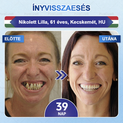 🦷🦷PuraCure® többhatású fog- és ínyregeneráló szájvíz | Kollagén × posztbiotikumok × β-glükanáz