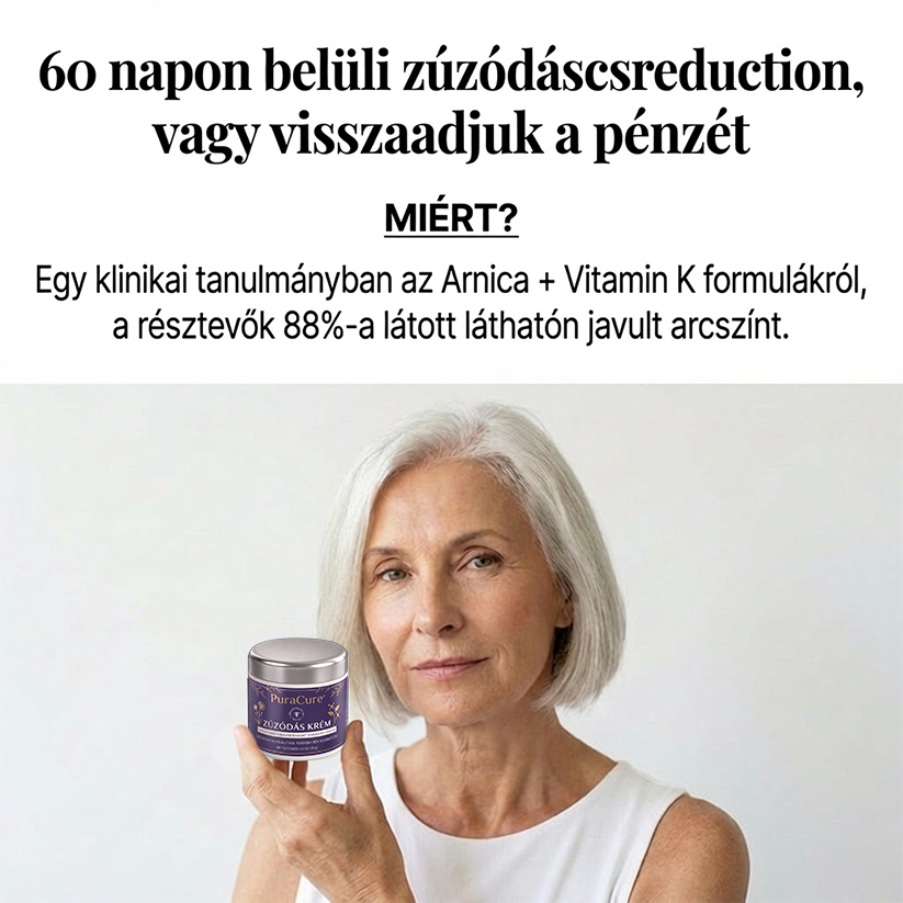 🔥100K+ ELADVA 💁‍♀️ – 💜PuraCure® Zúzódásjavító és bőrerősítő krém