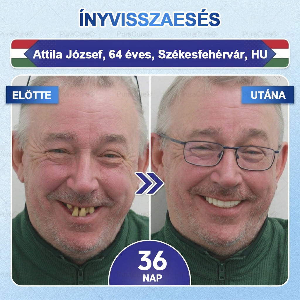 🦷🦷PuraCure® többhatású fog- és ínyregeneráló szájvíz | Kollagén × posztbiotikumok × β-glükanáz