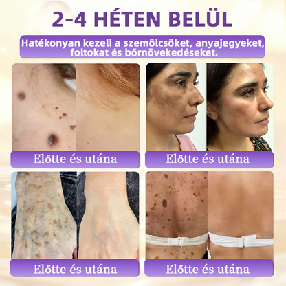💟Magyarországról szállítva ✨ NORUION® Biotin 10 az 1-ben bőrmegújító krém