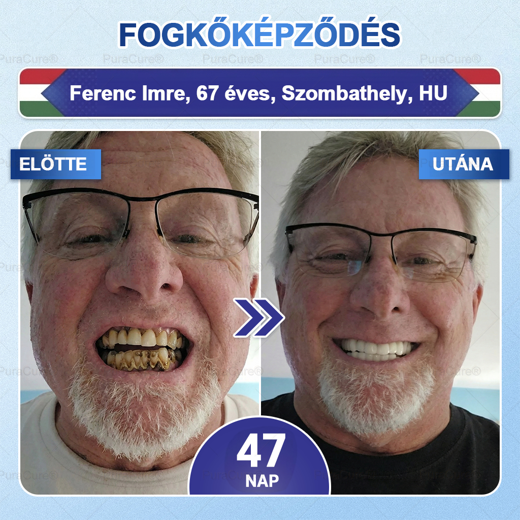 🦷🦷PuraCure® többhatású fog- és ínyregeneráló szájvíz | Kollagén × posztbiotikumok × β-glükanáz