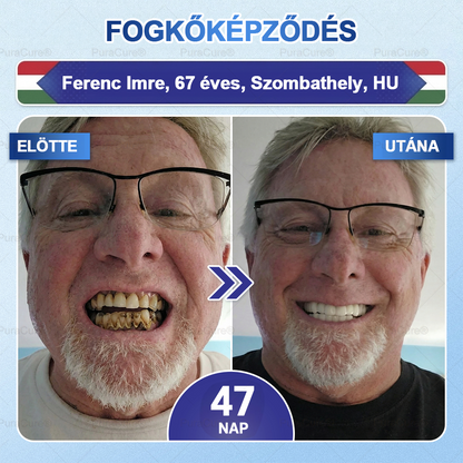 🦷🦷PuraCure® többhatású fog- és ínyregeneráló szájvíz | Kollagén × posztbiotikumok × β-glükanáz
