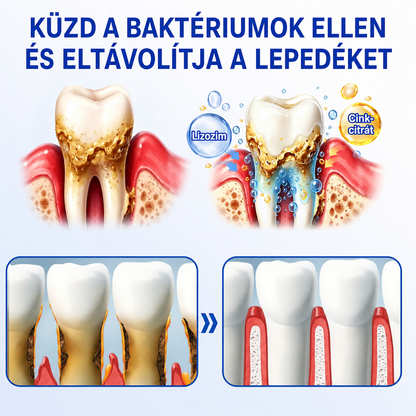 💧💧PuraCure® Ínymegújító – 🦷Célzott ínyápoló és regeneráló gél