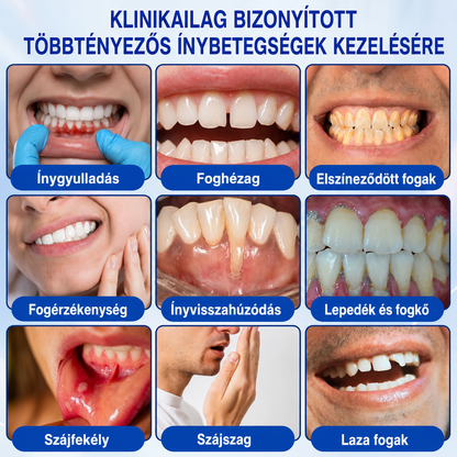 💧💧PuraCure® Ínymegújító – 🦷Célzott ínyápoló és regeneráló gél