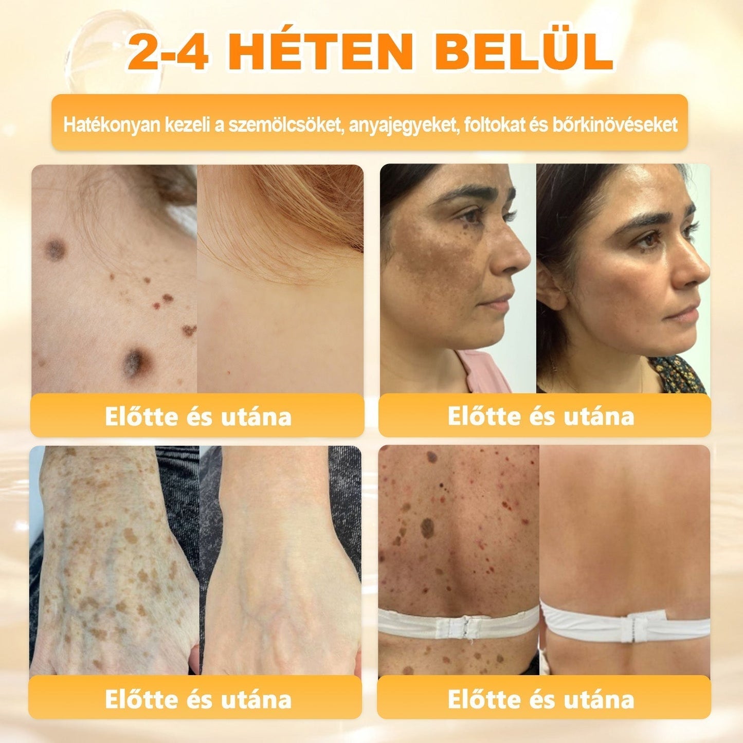 💛 𝐏𝐮𝐫𝐚𝐂𝐮𝐫𝐞® 𝐌é𝐡𝐦é𝐫𝐞𝐠 𝐁ő𝐫 𝐇𝐞𝐥𝐲𝐫𝐞á𝐥𝐥í𝐭ó 𝐊𝐫é𝐦 👨‍⚕‍CE Tanúsítvány ✅GMP-követő gyártási folyamat