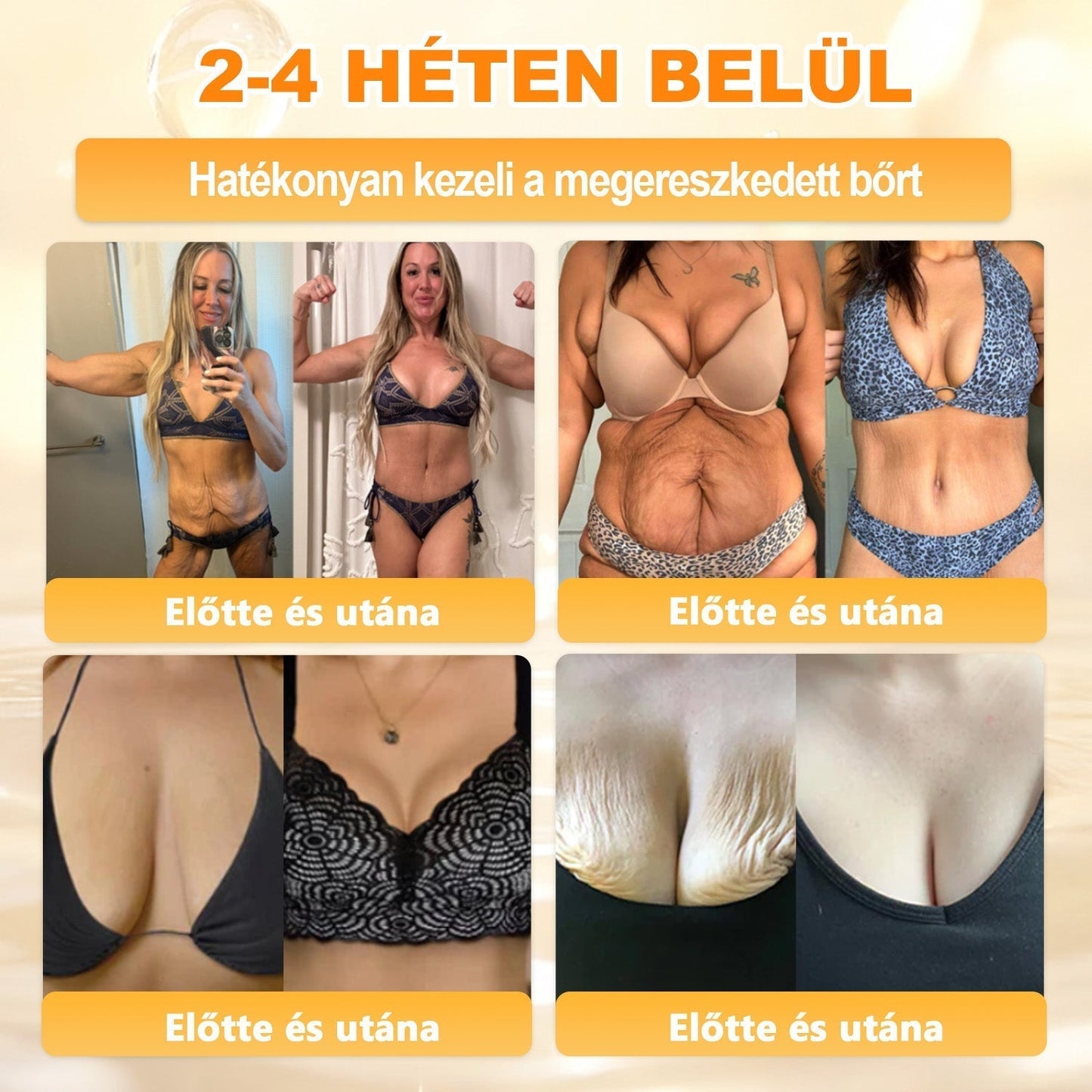 💛 𝐏𝐮𝐫𝐚𝐂𝐮𝐫𝐞® 𝐌é𝐡𝐦é𝐫𝐞𝐠 𝐁ő𝐫 𝐇𝐞𝐥𝐲𝐫𝐞á𝐥𝐥í𝐭ó 𝐊𝐫é𝐦 👨‍⚕‍CE Tanúsítvány ✅GMP-követő gyártási folyamat