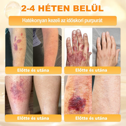💛 𝐏𝐮𝐫𝐚𝐂𝐮𝐫𝐞® 𝐌é𝐡𝐦é𝐫𝐞𝐠 𝐁ő𝐫 𝐇𝐞𝐥𝐲𝐫𝐞á𝐥𝐥í𝐭ó 𝐊𝐫é𝐦 👨‍⚕‍CE Tanúsítvány ✅GMP-követő gyártási folyamat