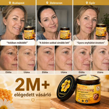 💛 𝐏𝐮𝐫𝐚𝐂𝐮𝐫𝐞® 𝐌é𝐡𝐦é𝐫𝐞𝐠 𝐁ő𝐫 𝐇𝐞𝐥𝐲𝐫𝐞á𝐥𝐥í𝐭ó 𝐊𝐫é𝐦 👨‍⚕‍CE Tanúsítvány ✅GMP-követő gyártási folyamat