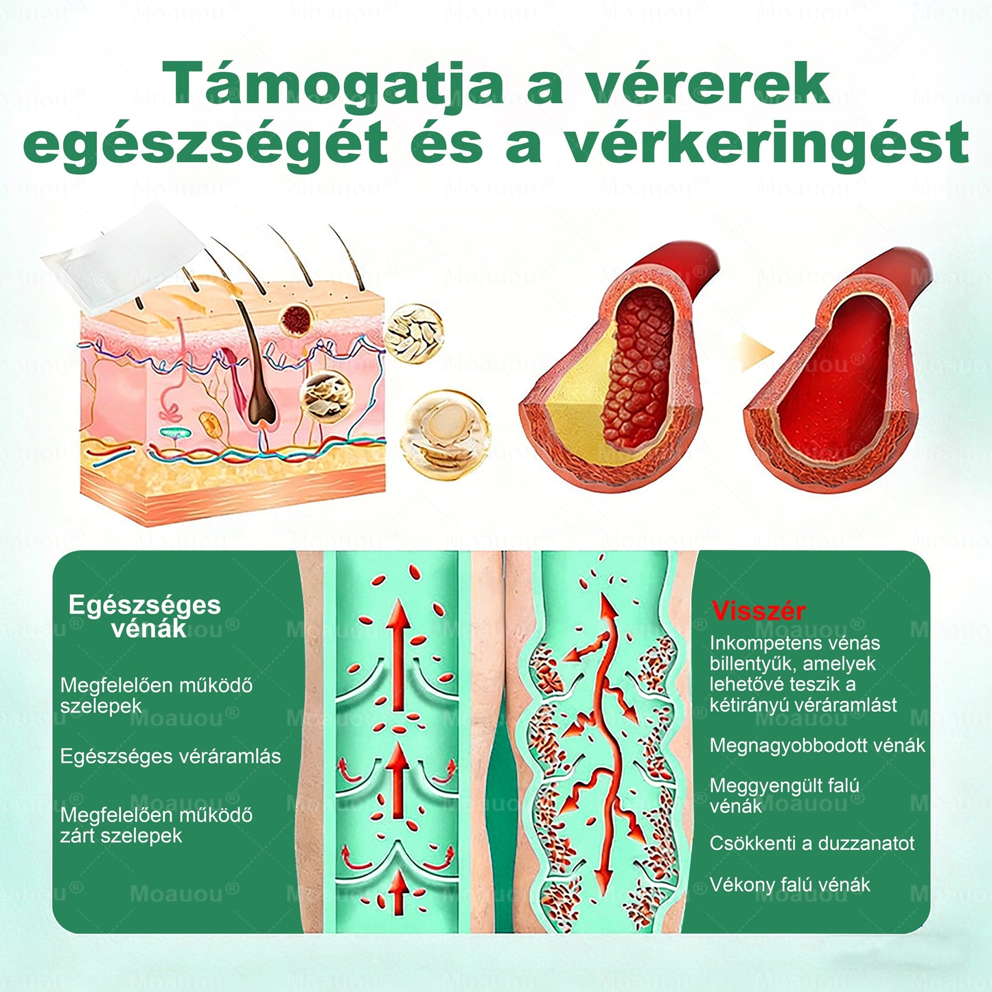 🌿🌿Moauou® Visszérápoló Mikrotűs Tapasz –👨‍⚕️Célzott ápolás fáradt, nehéz és feszülő lábakra | NAGY AKCIÓ!