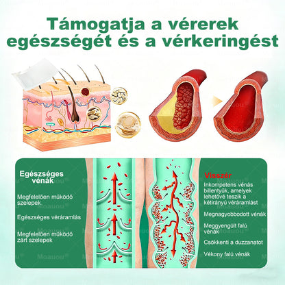 🌿🌿Moauou® Visszérápoló Mikrotűs Tapasz –👨‍⚕️Célzott ápolás fáradt, nehéz és feszülő lábakra | NAGY AKCIÓ!